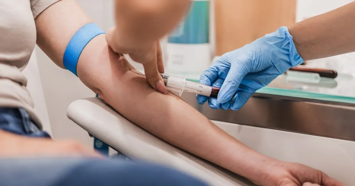 Thyroid Stimulating Hormone ( TSH )