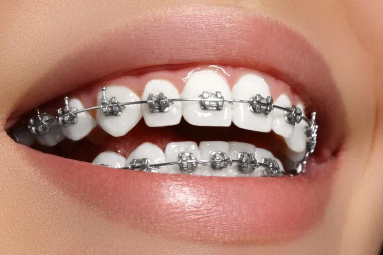 Ortho Treatments