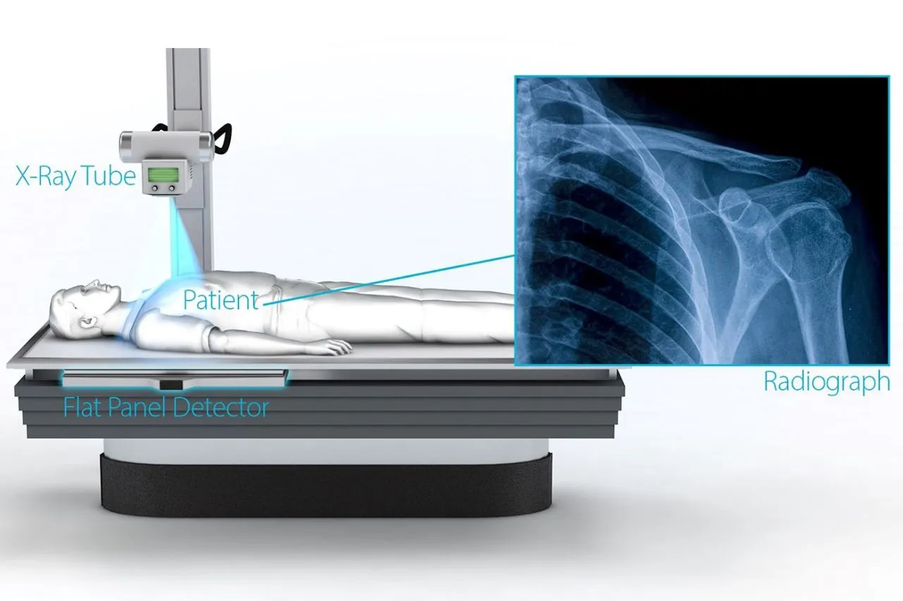 Digital X-Ray