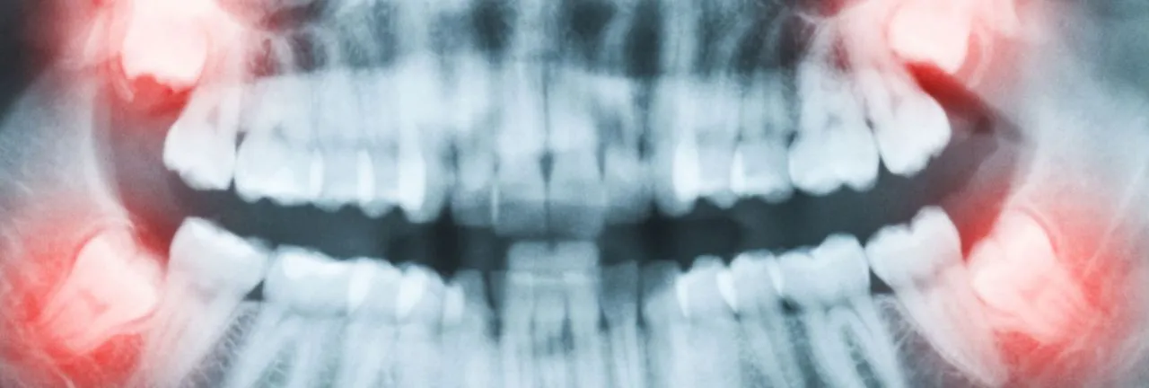 Checkup And Digital X-ray