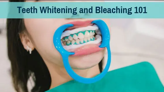 Bleaching/Teeth Whitening
