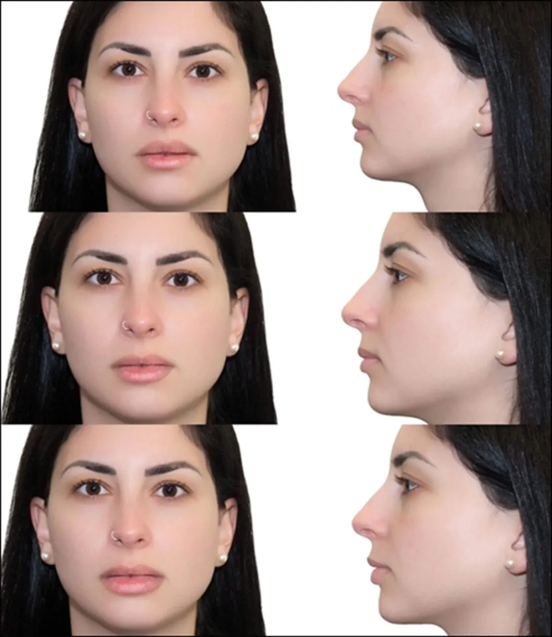 Upper lips Forehead Threading