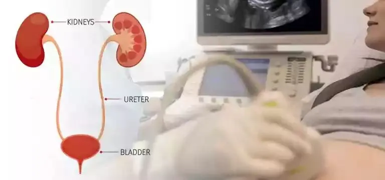 KUB PROSTATE & PVR