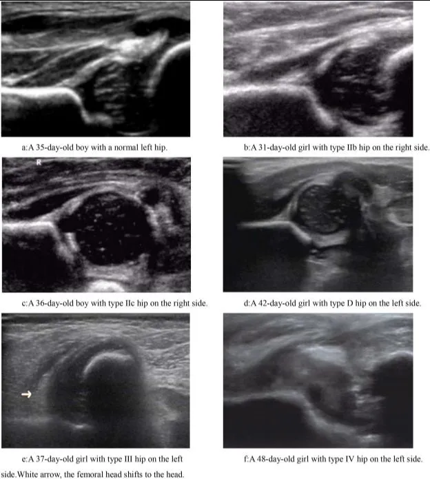 INFANT BRAIN / INFANT HIP