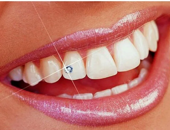 Tooth Jewellery