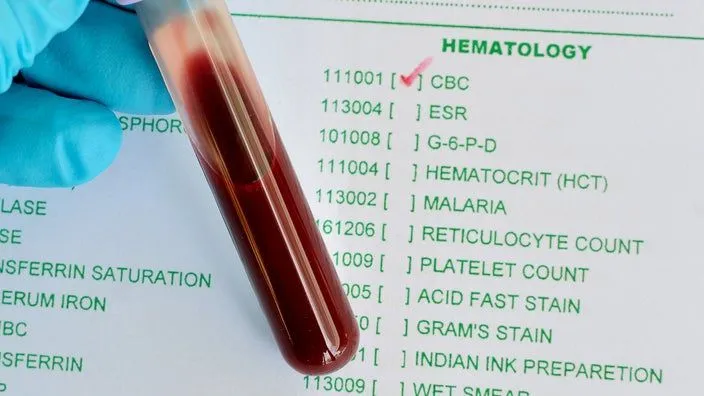 CBC ( Complete Blood Count )