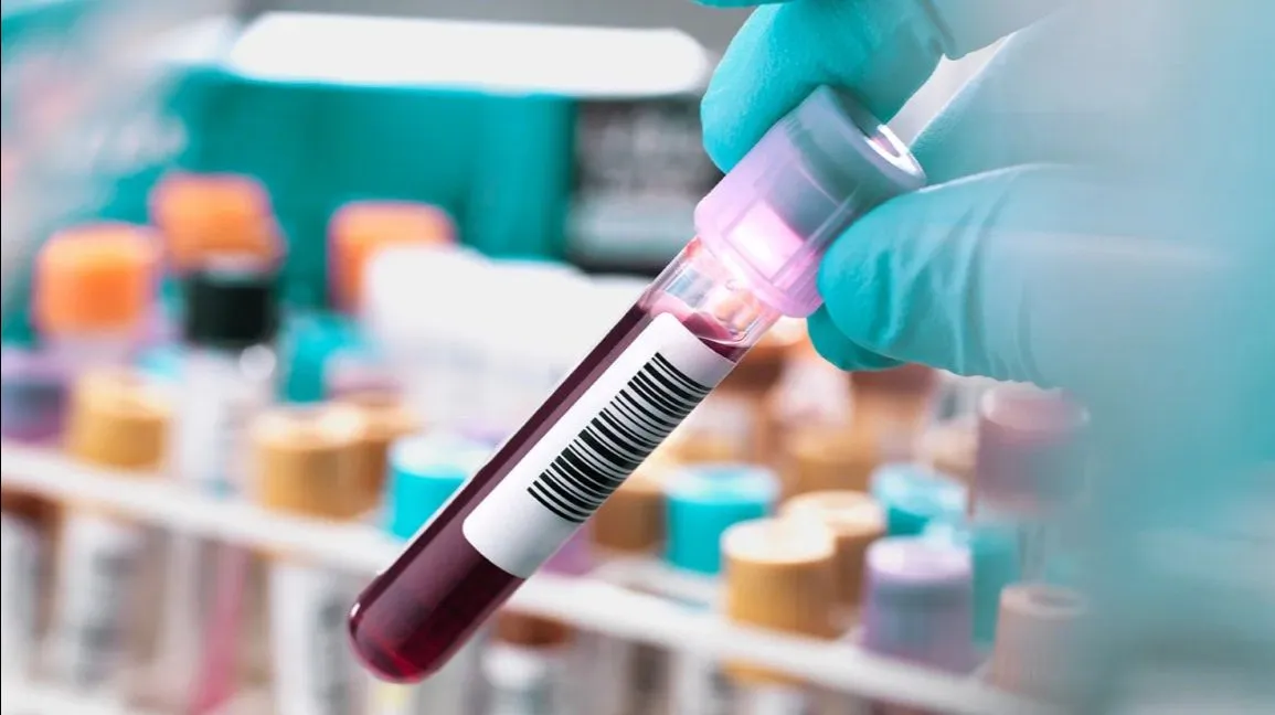 Kidney Function Test ( KFT ) PROFILE
