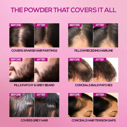 RENEE Cover Up Hair Powder view 6