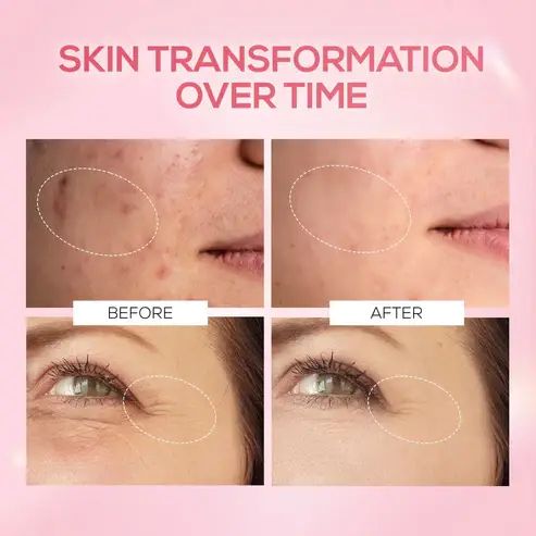 RENEE Pink Therapy PDRN Pink Peptide Serum view 6