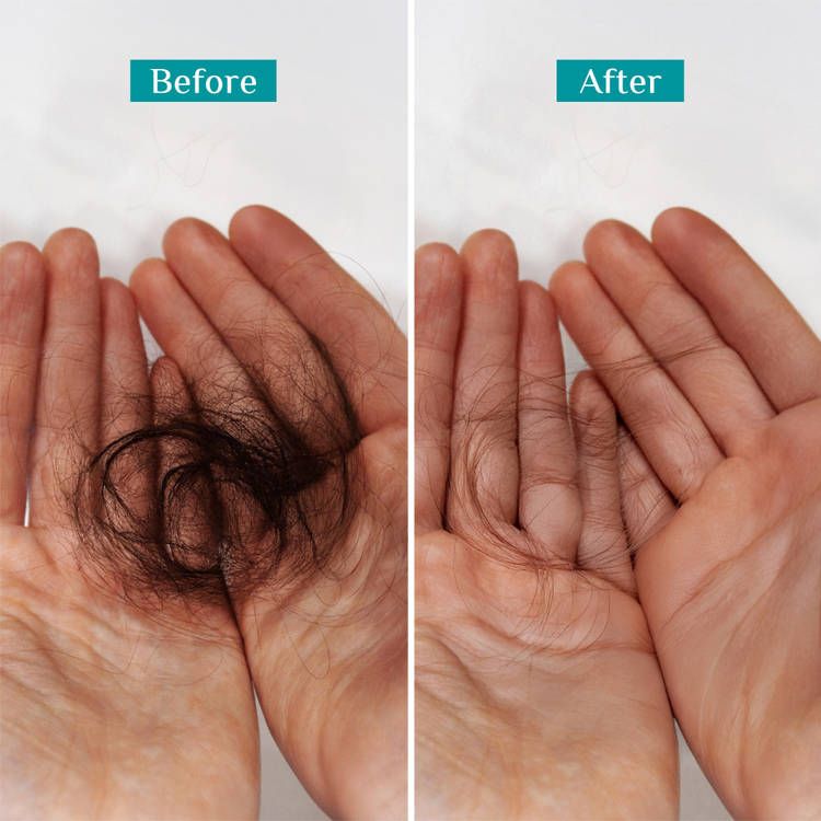 Pilgrim
Spanish Rosemary & Biotin Hair GrowthOil Control Hairfall Thick Strong Hair with view 5